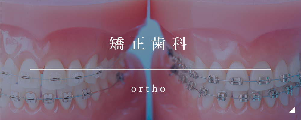 矯正歯科 ORTHO